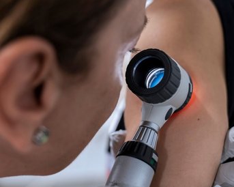 Der Dermatologe untersucht Muttermale auf der Haut des Patienten mit einem Dermatoskop.